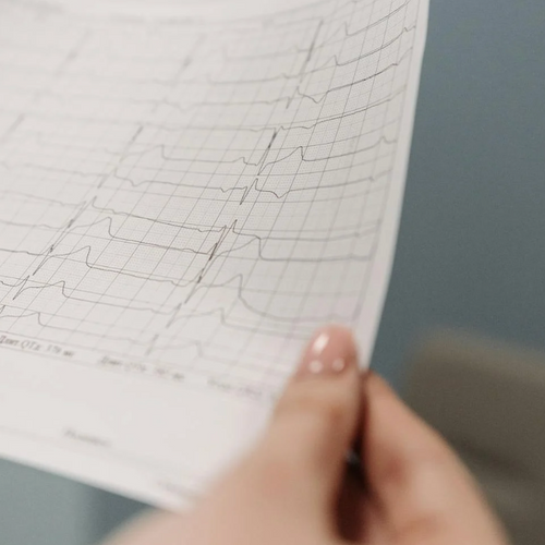EKG Only
