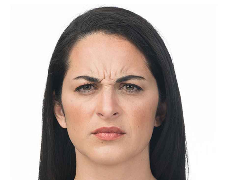 Botox cosmetic weston Before frown lines woman face.png